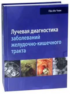 Li, Mi, Soo: Лучевая диагностика заболеваний желудочно-кишечного тракта