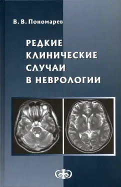 Владимир Пономарев: Редкие клинические случаи в неврологии (случаи из практики). Руководство для врачей