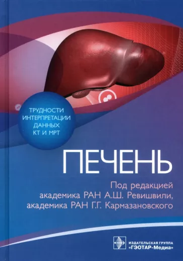 Ревишвили, Кармазановский, Груздев: Трудности интерпретации данных КТ и МРТ. Печень