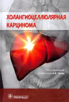 Чжао, Бугаев, Варава: Холангиоцеллюлярная карцинома