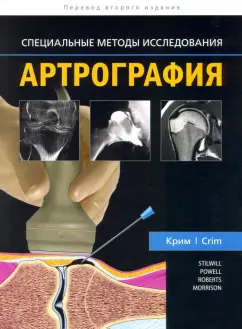 Крим, Stiwill: Артрография
