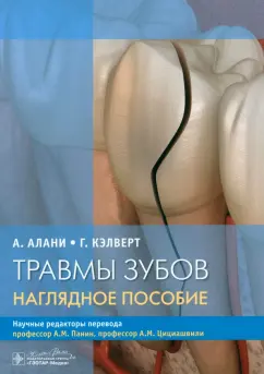 Алани, Кэлверт: Травмы зубов. Наглядное пособие