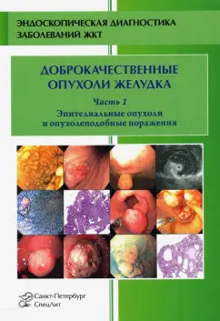 Кузин, Радовский, Добронец: Доброкачественные опухоли и опухолеподобные поражения желудка. Часть 1. Эпителиальные опухоли