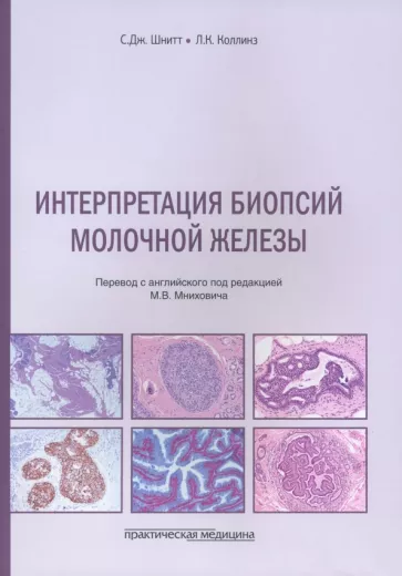 Шнитт, Коллинз: Интерпретация биопсий молочной железы