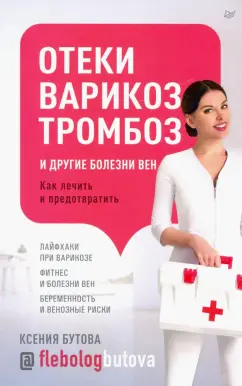 Ксения Бутова: Отеки, варикоз, тромбоз и другие болезни вен. Как лечить и предотвратить
