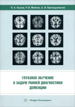 Пылов, Протодьяконов, Майтак: Глубокое обучение в задаче ранней диагностики деменции. Монография