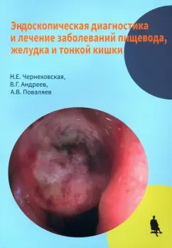 Чернеховская, Поваляев, Андреев: Эндоскопическая диагностика и лечение заболеваний пищевода, желудка и тонкой кишки