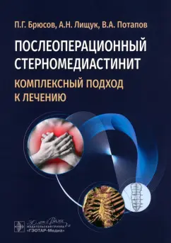 Брюсов, Лищук, Потапов: Послеоперационный стерномедиастинит. Комплексный подход к лечению