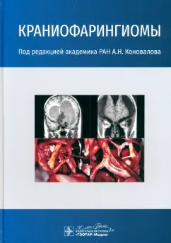 Александр Коновалов: Краниофарингиомы