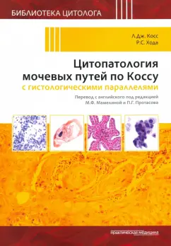 Косс, Хода: Цитопатология мочевых путей по Коссу с гистологическими параллелями