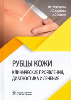 Мантурова, Круглова, Стенько: Рубцы кожи. Клинические проявления, диагностика и лечение