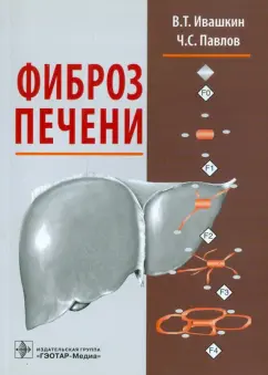 Ивашкин, Павлов: Фиброз печени