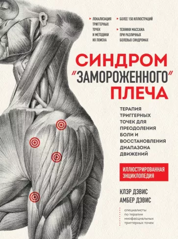 Клэр Дэвис: Синдром "замороженного" плеча. Терапия триггерных точек для преодоления боли и восстановления