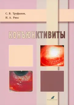 Труфанов, Рикс: Коньюктивиты. Учебное пособие