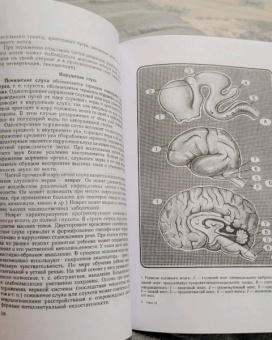 Левон Бадалян: Невропатология