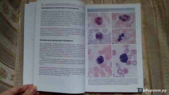 Тэмл, Диам, Хаверлах: Атлас по гематологии