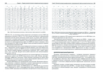 Шалькевич, Кудлач, Кот: Эпилепсия у детей. Редкие и атипичные формы. Руководство для врачей