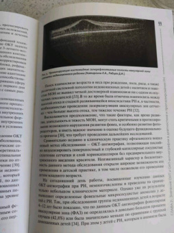 Владимир Нероев: Ретинопатия недоношенных