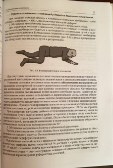 Александрович, Иванов, Гузева: Неотложная неврология у новорожденных и детей раннего возраста