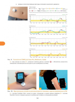 Олег Удовиченко: Сахарный диабет. Современное лечение