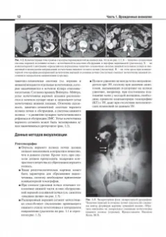 Олдер, Бассиньяни: Атлас визуализации в урологии