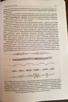 Александрович, Иванов, Гузева: Неотложная неврология у новорожденных и детей раннего возраста