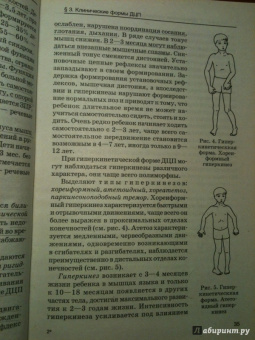 Шипицына, Мамайчук: Психология детей с нарушениями функций опорно-двигательного аппарата