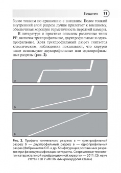 Лоскутов, Кузнецов: Техника роговичного разреза в хирургии катаракты