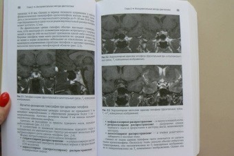 Абдулхабирова, Андреева, Белая: Эндокринология. Национальное руководство. Краткое издание