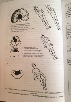 Александрович, Иванов, Гузева: Неотложная неврология у новорожденных и детей раннего возраста