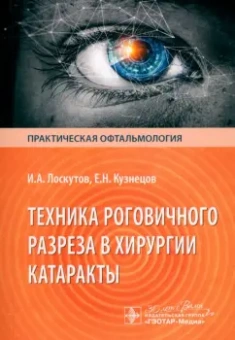 Лоскутов, Кузнецов: Техника роговичного разреза в хирургии катаракты