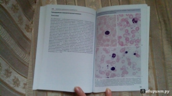 Тэмл, Диам, Хаверлах: Атлас по гематологии
