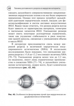 Лоскутов, Кузнецов: Техника роговичного разреза в хирургии катаракты