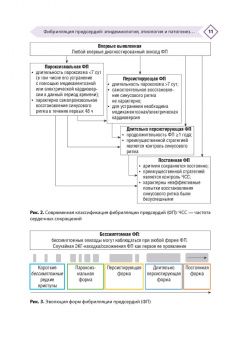Напалков, Соколова, Жиленко: Фибрилляция предсердий. Антикоагулянтная терапия в таблицах и схемах
