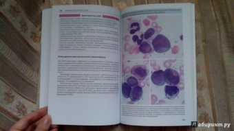 Тэмл, Диам, Хаверлах: Атлас по гематологии