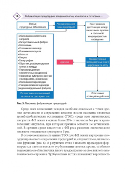 Напалков, Соколова, Жиленко: Фибрилляция предсердий. Антикоагулянтная терапия в таблицах и схемах
