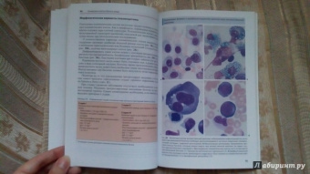 Тэмл, Диам, Хаверлах: Атлас по гематологии