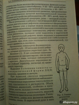 Шипицына, Мамайчук: Психология детей с нарушениями функций опорно-двигательного аппарата