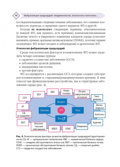 Напалков, Соколова, Жиленко: Фибрилляция предсердий. Антикоагулянтная терапия в таблицах и схемах