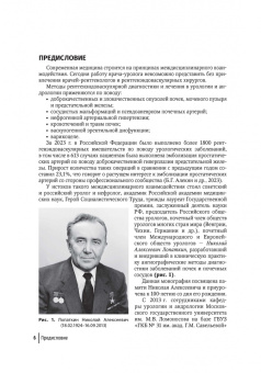 Камалов, Карпов, Шапаров: Эмболизация простатических артерий в лечении доброкачественной гиперплазии предстательной железы