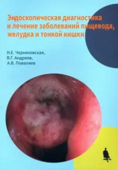 Чернеховская, Поваляев, Андреев: Эндоскопическая диагностика и лечение заболеваний пищевода, желудка и тонкой кишки