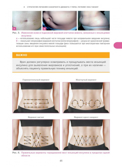 Олег Удовиченко: Сахарный диабет. Современное лечение