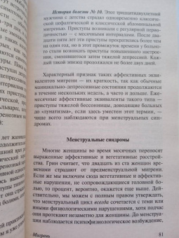Оливер Сакс: Мигрень