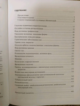 Нероев, Катаргрина, Садомова: Офтальмология. Клинические рекомендации