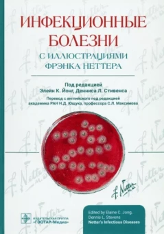 Йонг, Стивенс: Инфекционные болезни с иллюстрациями Фрэнка Неттера