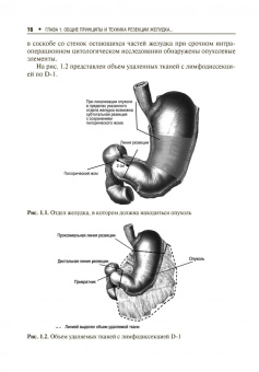 Мерцалов, Куликов: Результаты и качество жизни больных после пилоросохранной резекции желудка при раке