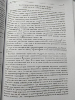 Александрович, Иванов, Гузева: Неотложная неврология у новорожденных и детей раннего возраста