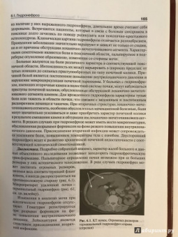 Борис Комяков: Урология