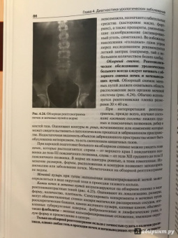 Борис Комяков: Урология