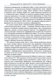 Михайловский, Дюбуссе: Болезнь Шойерманна